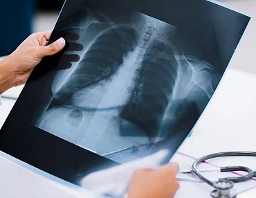 16933868161425839176