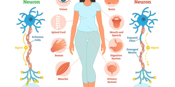 Multipl Skleroz Hastalığı Hakkında Bilinmeyenler